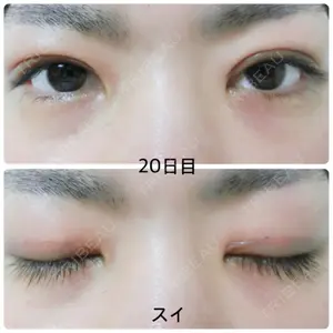 東京皮膚科・形成外科 東京皮膚科・形成外科 (銀座いけだクリニック)口コミ