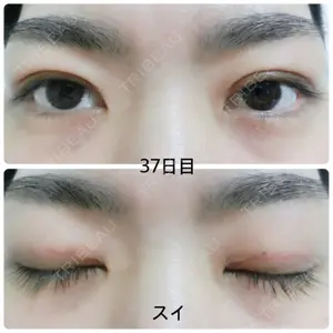 東京皮膚科・形成外科 東京皮膚科・形成外科 (銀座いけだクリニック)口コミ