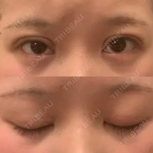 中央クリニック 大阪梅田中央クリニック美容外科口コミ