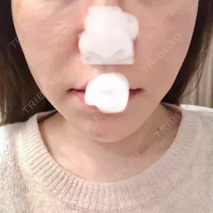 ウィーバー美容外科口コミ