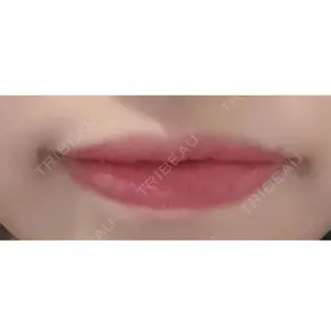 B-LINE CLINIC B-LINE CLINIC 池袋院口コミ