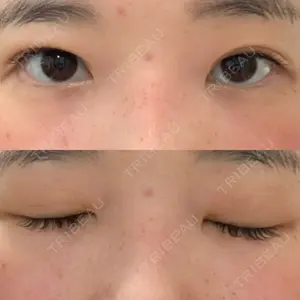 湘南美容クリニック 湘南美容クリニック 東京蒲田院口コミ