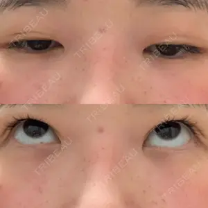 湘南美容クリニック 湘南美容クリニック 東京蒲田院口コミ