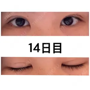 口コミ