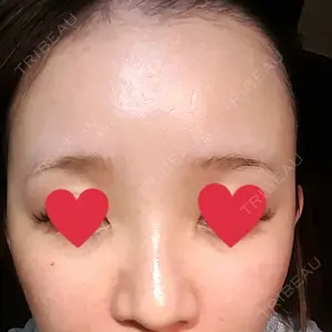 abijouクリニック口コミ