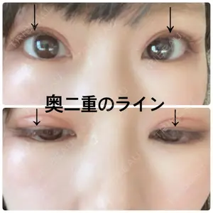 高須クリニック 銀座高須クリニック口コミ