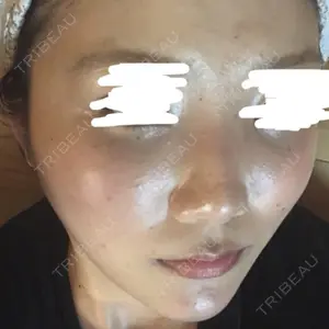 ニューセンス皮膚科クリニック口コミ