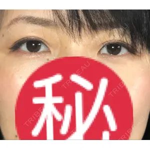 口コミ
