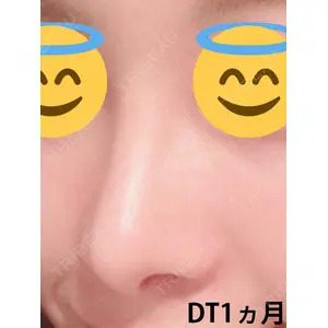 マーブル整形外科口コミ