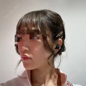 ボンディ美容整形外科（旧リオン整形外科）口コミ