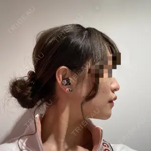 ボンディ美容整形外科（旧リオン整形外科）口コミ