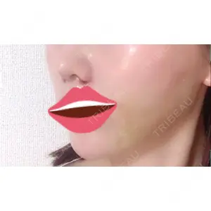 TAクリニック 大阪TAクリニック口コミ