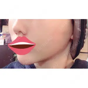 TAクリニック 大阪TAクリニック口コミ