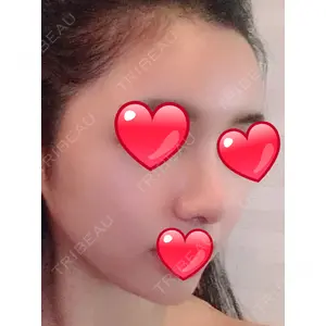 マーブル美容整形外科の