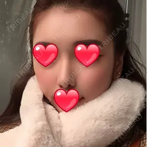 マーブル美容整形外科の