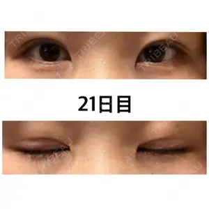 口コミ