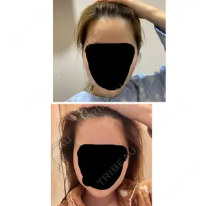 ボンディ美容整形外科（旧リオン整形外科）口コミ