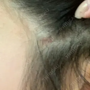 ボンディ美容整形外科（旧リオン整形外科）口コミ