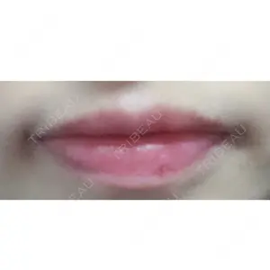 B-LINE CLINIC B-LINE CLINIC 池袋院口コミ