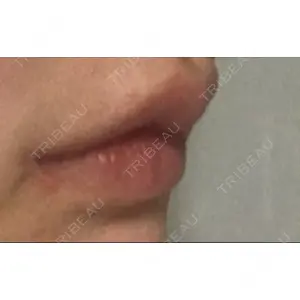 現代美学整形外科口コミ