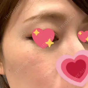 南青山TOKUNAKAクリニック口コミ