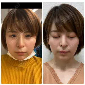 Zetith Beauty Clinic 銀座院口コミ