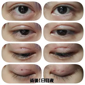 湘南美容クリニック 湘南美容クリニック 宇都宮院口コミ