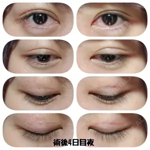 湘南美容クリニック 湘南美容クリニック 宇都宮院口コミ