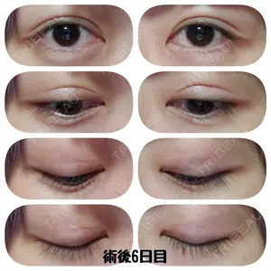 湘南美容クリニック 湘南美容クリニック 宇都宮院口コミ