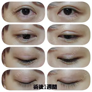 湘南美容クリニック 湘南美容クリニック 宇都宮院口コミ