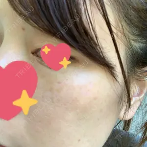 南青山TOKUNAKAクリニック口コミ