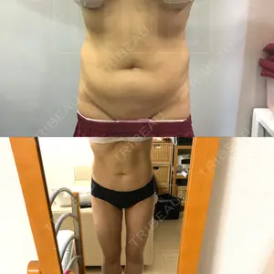 狎鴎亭トップライン医院口コミ
