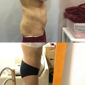 狎鴎亭トップライン医院口コミ