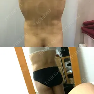 狎鴎亭トップライン医院口コミ