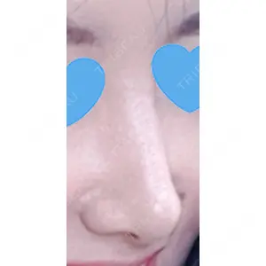 口コミ