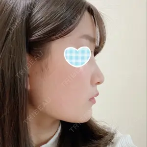 口コミ