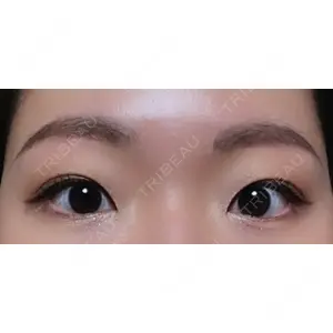 Lovelyan整形外科口コミ