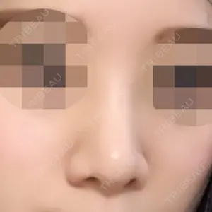 口コミ