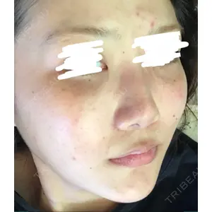 ニューセンス皮膚科クリニック口コミ