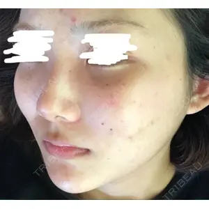 ニューセンス皮膚科クリニック口コミ