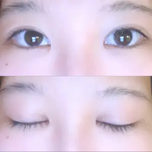 Lovelyan整形外科口コミ