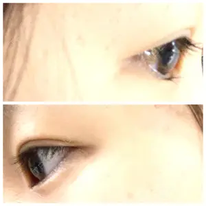 口コミ