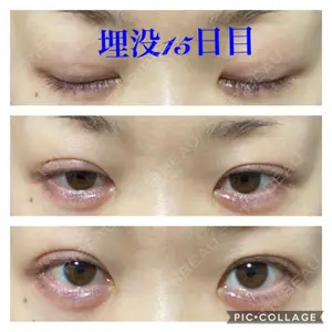 水の森美容クリニックの口コミ