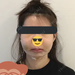 View美容整形外科口コミ