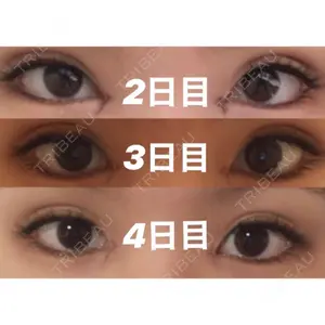 湘南美容クリニック 湘南美容クリニック 赤坂見附院口コミ