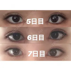 湘南美容クリニック 湘南美容クリニック 赤坂見附院口コミ