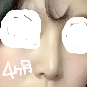 マーブル整形外科口コミ