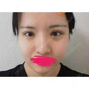 ボンディ美容整形外科（旧リオン整形外科）口コミ