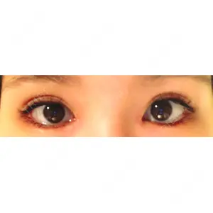 湘南美容クリニック 湘南美容クリニック 赤坂見附院口コミ