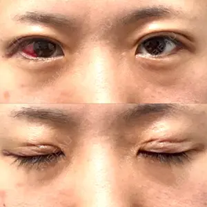 湘南美容クリニック 湘南美容クリニック 松山院口コミ